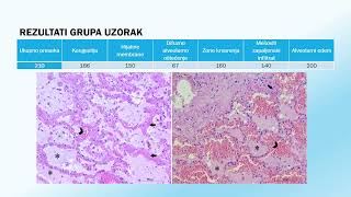 Doktorat  Jelena Kuzmanović  Uloga interleukina 6 8 i 18 u patogenezi akutnog respiratornog [upl. by Levenson]