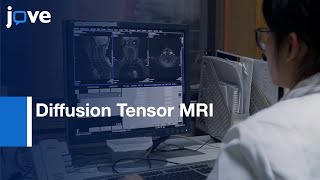 Diffusion Tensor MRI in Chronic Spinal Cord Compression  Protocol Preview [upl. by Baily934]