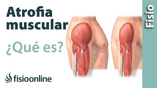 Atrofia muscular  Qué es y cómo sucede [upl. by Dranyam]