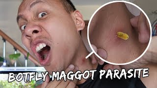 I Have a Botfly Maggot Parasite Inside My Neck  Vlog 371 [upl. by Dekeles]