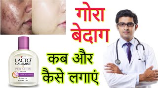 Lacto Calamine face lotion HONEST Review 2023 in hindi  Results Benefits Uses Price Info [upl. by Orihakat]