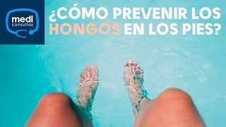 ¿Cómo puedo prevenir los hongos en los pies MediConsultas [upl. by Belita781]