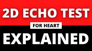 Heart 2D Echo Test Explained in English  2D Echo Test For Heart [upl. by Annaid245]