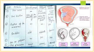 obstetrical emergency cord prolapse NGMedicals [upl. by Milla2]