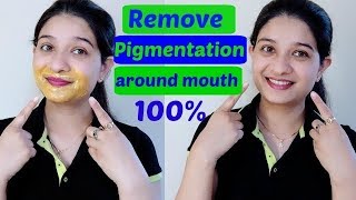 How to remove dark patches spots  pigmentation around your mouth fast amp naturally in Hindi [upl. by Eelrefinnej823]