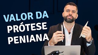 Qual o Valor da Prótese Peniana  Dr Marco Túlio  Urologista e Andrologista responde [upl. by Eppillihp372]