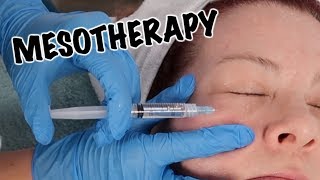 Mesotherapy Facial  Anti Aging Treatment [upl. by Atiuqahc85]