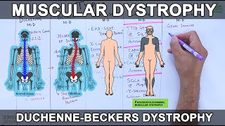 Muscular Dystrophy  Types and Mutations [upl. by Mahon]