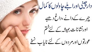 Secrets to Remove Pimples Dark Spots Acne Holes amp Scars Overnight Complete Treatment in Urdu Hindi [upl. by Jarib]