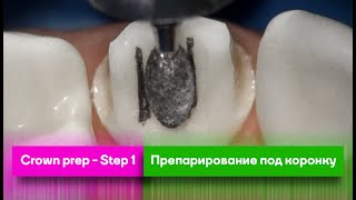 Crown prep  Step 1  Препарирование под коронку [upl. by Osrock]