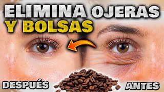 ELIMINA OJERAS BOLSAS y ARRUGAS en MINUTOS ANTIOJERAS EFECTIVO y NATURAL  Cómo quitar las Ojeras [upl. by Mot]