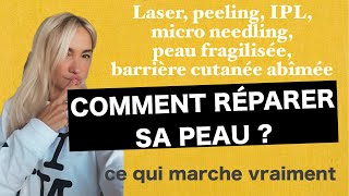 ⚠️LASER PEELING MICRONEEDLING IPL BARRIÈRE CUTANÉE FRAGILISÉE PEAU ABÎMÉE  RÉPARER SA PEAU [upl. by Martinson]