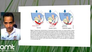 Biomecanica del Piso pelvico [upl. by Asirem]