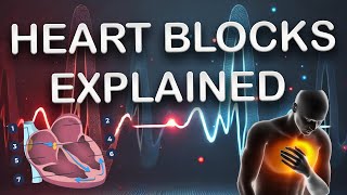 EKG Basics Explained Understanding Heart Blocks [upl. by Deuno]