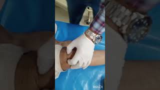 How to inject intraarticular steroids in knee joint  Osteoarthritis [upl. by Ysirhc561]