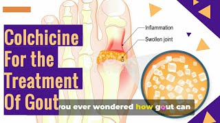 COLCHICINE Tablets For The GOUT Treatment [upl. by Newcomer70]