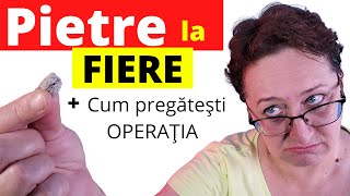 Cum STII daca ai PIETRE la FIERE Operatia de LITIAZA BILIARA [upl. by Naellij]