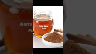 Anti Acne Mask  Cinnamon And Honey Paste  Quick Tips For Pimples  LITTLE TIPS shortspimplefree [upl. by Wildee]