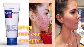 ব্রণ দূর করার কার্যকরী ফেসওয়াশ Mistine Acne Clear Facial Foam facewash  bangla review [upl. by Namrac]