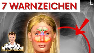 AUTOIMMUNERKRANKUNG Immunattacken erkennen RheumaArzt erklärt Warnzeichen [upl. by Ennahgem]