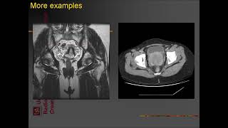 ultrasound radiologysonology [upl. by Tita]