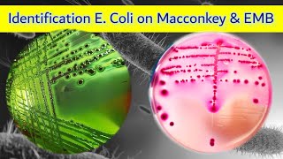 Escherichia coli Identification on Macconkey and EMB agar [upl. by Barby]