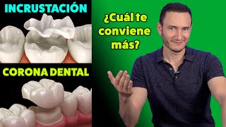 Incrustación vs Corona Dental ¿Cuál te conviene más  Cuando está indicada [upl. by Nicole398]