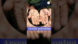 Arsenic poisoning in UP posion harmful up [upl. by Rabi]