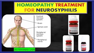 Homeopathic Medicines for Neurosyphilis  Syphilis  brain  spinal cord drpriyankashomeopathy [upl. by Dew41]