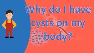 Why do I have cysts on my body  Top Health FAQS [upl. by Eissalc451]