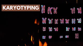 Karyotyping  Human Genetics  Cytogenetics [upl. by Hemminger]