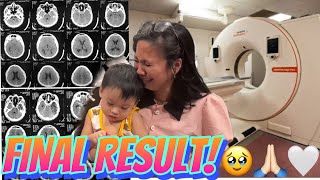 NAKAKAIYAK ANG RESULTA NG CT SCAN NI GAB [upl. by Niltak479]