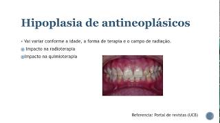 Anomalias dentárias 01 Resumos de odonto [upl. by Mauricio]