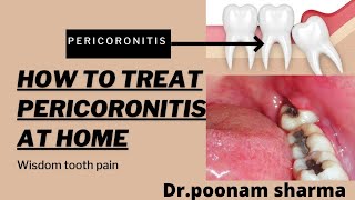 How to Treat Pericoronitis at Home Home Remedies for Pericoronitis [upl. by Zipah718]