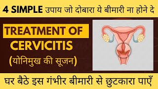 सर्विसाइटिस Cervicitis के घरेलू इलाज । CERVICITIS CURE । Treatment of Cervicitis [upl. by Evanthe]