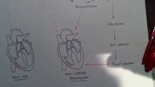 Cardiac Remodeling  Part 1  The Pathogenesis [upl. by Whitcomb]