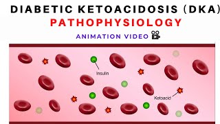 Pathophysiology of Diabetic Ketoacidosis DKA  Animation [upl. by Nitsej]