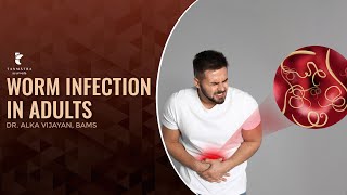 Worm Infection in Adults  Dr Alka Vijayan [upl. by Isied]