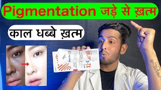 Skarfix tx cream  fixderma skarfix tx cream  Skarfix tx cream review  ये क्रीम हमारे pigmentation [upl. by Crandall]