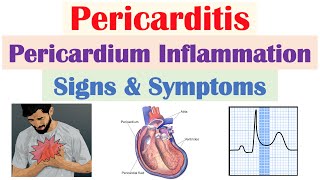 Pericarditis Pericardial Inflammation Signs amp Symptoms amp Why They Occur [upl. by Aiclid]