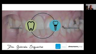 Biomateriales Uso de Biomateriales en Cirugía Periodontal e Implantología Dra Gabriela Sifuentes [upl. by Ttej585]