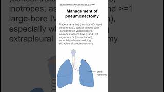 Management of pneumonectomy [upl. by Huei]