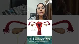 एन्डोमेट्रीओसिस क्या है What is Endometriosis Hindi  Dr Uma Mishra Raipur [upl. by Noemi]