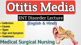 Otitis Media  Otitis Media In Hindi [upl. by Atteyek]