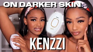 HOME LASER HAIR REMOVER DEMO amp REVIEW Kenzzi on darker skin Is it safe [upl. by Deena123]