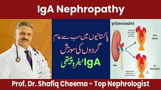 Causes Diagnosis amp Treatment of IgA Nephropathy [upl. by Marwin20]