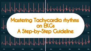 How to read EKG for arrhythmias  Tachycardia rhythms [upl. by Teria898]