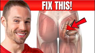 How To Fix Piriformis Syndrome Causes Symptoms Treatment [upl. by Yorgo]