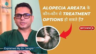 What are the Treatment Options for Alopecia Areata  Hair Transplant Surgeon in Delhi [upl. by Ploss]