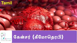 புற்றுநோய்  கீமோதெரபி   Cancer Chemotherapy  Tamil [upl. by Anne-Corinne]